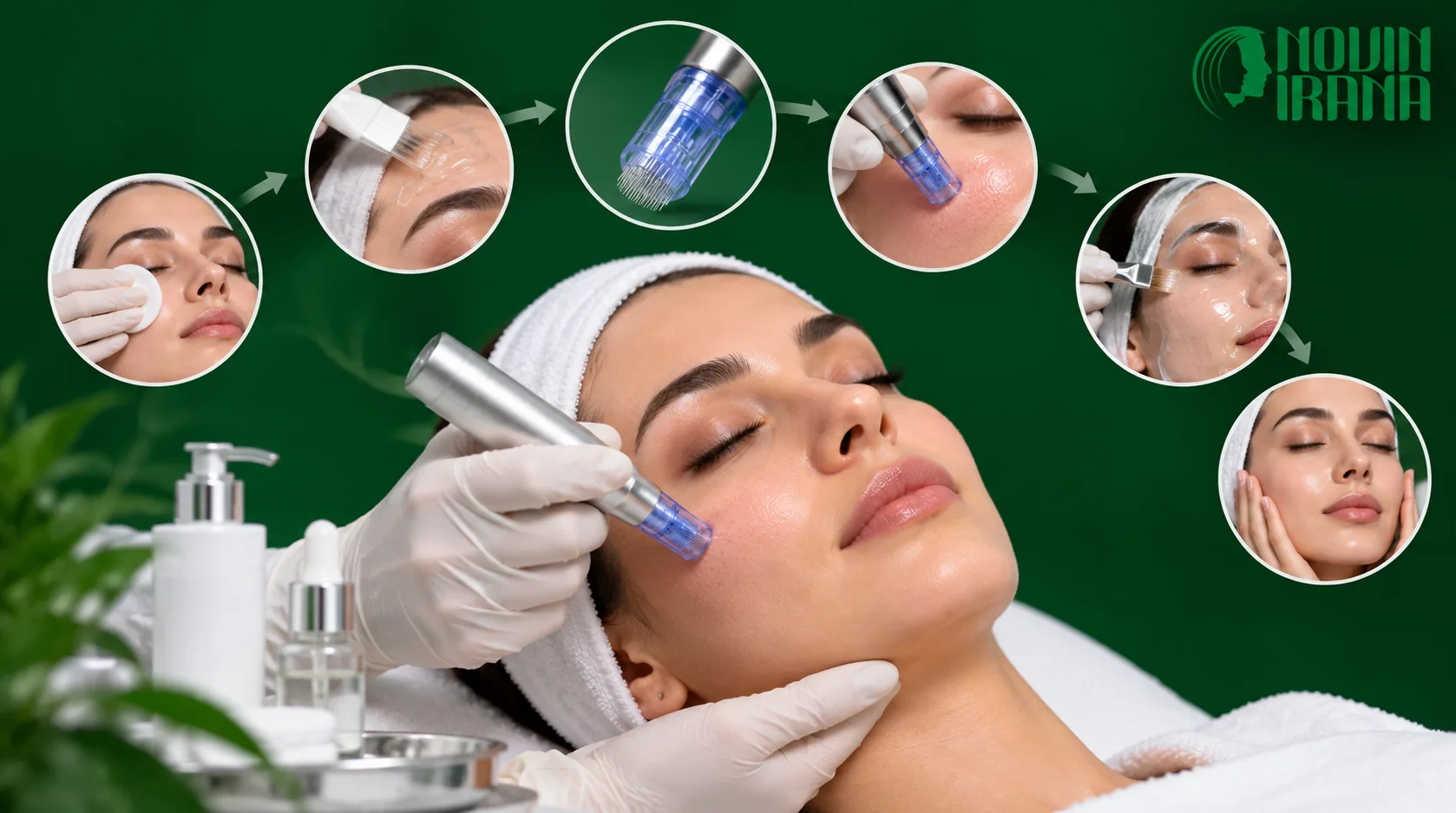 مراحل انجام میکرونیدلینگ در مشهد